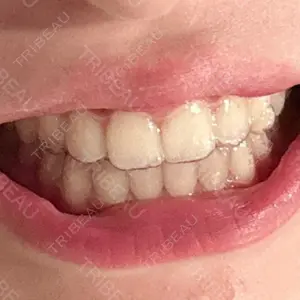 U DENTAL OFFICE 恵比寿口コミ