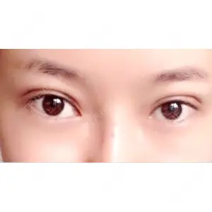 TCB東京中央美容外科 TCB東京中央美容外科 中野院口コミ