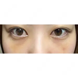 APOLLO BEAUTY CLINIC口コミ