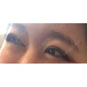 表参道スキンクリニック 表参道スキンクリニック 表参道院口コミ