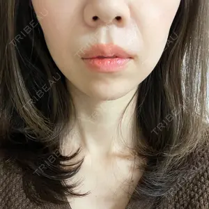 東京シンデレラ美容外科 東京シンデレラ美容外科 池袋院口コミ