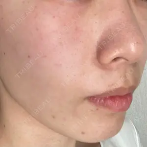 Rinato Beauty Clinic口コミ