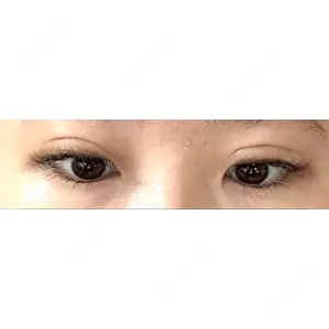 湘南美容クリニック 湘南美容クリニック 新宿南口院口コミ
