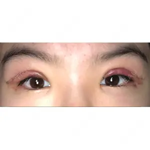 ブリスクリニック形成外科・美容外科・美容皮膚科 福岡口コミ