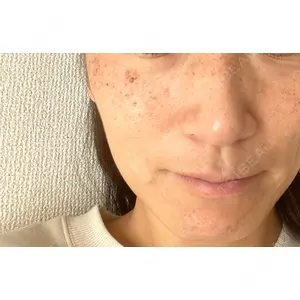 まゆりなclinic 名古屋栄口コミ