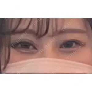 JBCジュノビューティークリニック 新宿三丁目院口コミ