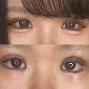 口コミ