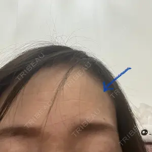 TCB東京中央美容外科 TCB東京中央美容外科 自由が丘院口コミ