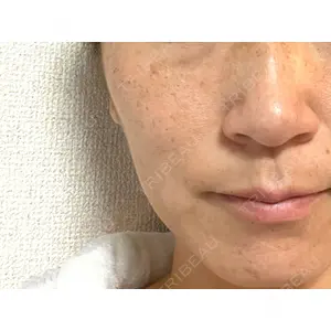 まゆりなclinic 名古屋栄口コミ