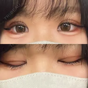 口コミ