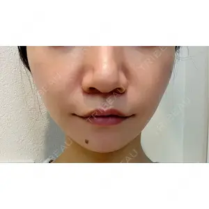 渋谷美容外科クリニック 渋谷美容外科クリニック 渋谷院口コミ