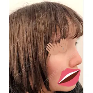 新宿ラクル美容外科クリニック 新宿ラクル美容外科クリニック 新宿院口コミ