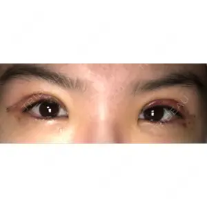 ブリスクリニック形成外科・美容外科・美容皮膚科 福岡口コミ