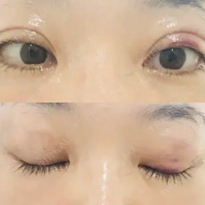 湘南美容クリニック 湘南美容クリニック 表参道院口コミ