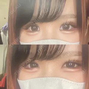 口コミ
