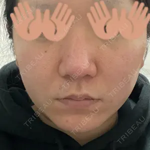 湘南美容クリニック 湘南美容クリニック 銀座院口コミ