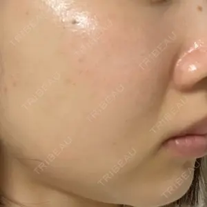 RAISE CLINIC 【レイズクリニック】口コミ