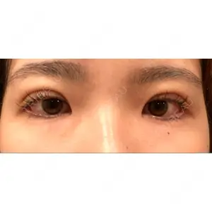 湘南美容クリニック 湘南美容クリニック 池袋東口院口コミ
