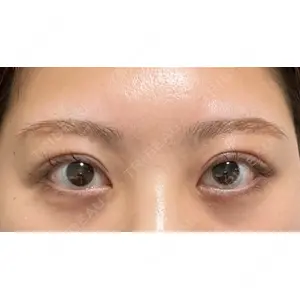 東郷美容形成外科 福岡口コミ