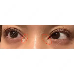 TCB東京中央美容外科 TCB東京中央美容外科 心斎橋筋院口コミ