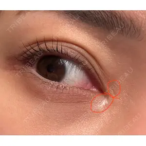 TCB東京中央美容外科 TCB東京中央美容外科 心斎橋筋院口コミ