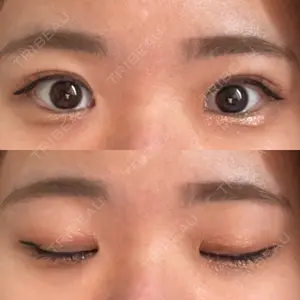 東京BELLEZZAクリニック口コミ