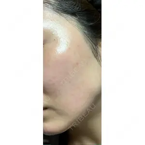 APOLLO BEAUTY CLINIC口コミ