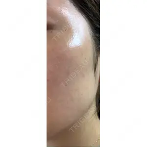 APOLLO BEAUTY CLINIC口コミ