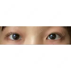 R.O.clinic口コミ