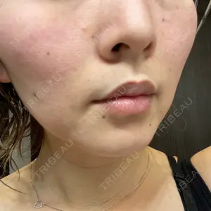 Rosa Beauty Clinic口コミ