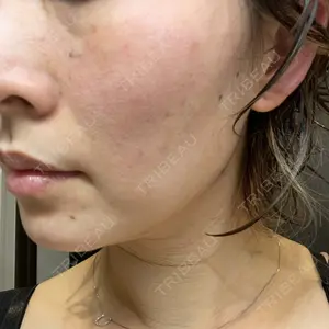 Rosa Beauty Clinic口コミ