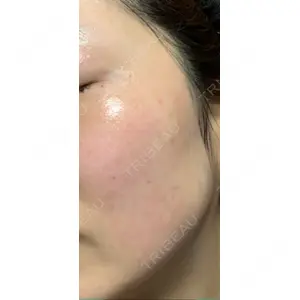 APOLLO BEAUTY CLINIC口コミ