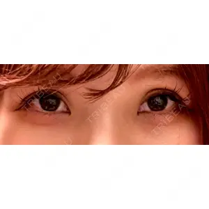 HAAB×DREAM BEAUTY CLINIC HAAB×DREAM BEAUTY CLINIC 東京本院口コミ