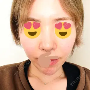 Rosa Beauty Clinic口コミ