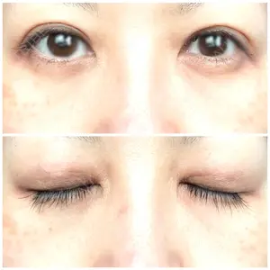 APOLLO BEAUTY CLINIC口コミ