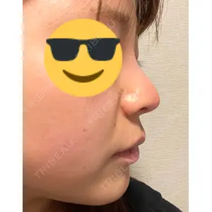 グローバルビューティークリニック グローバルビューティークリニック 東京院口コミ