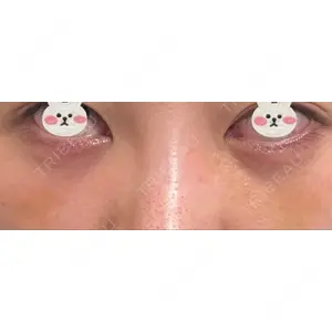 APOLLO BEAUTY CLINIC口コミ