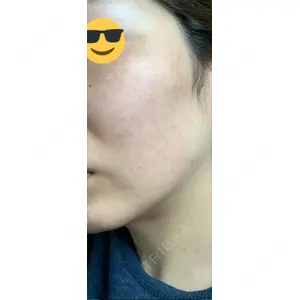 APOLLO BEAUTY CLINIC口コミ