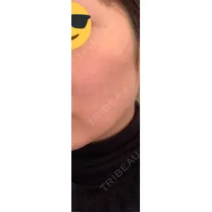 APOLLO BEAUTY CLINIC口コミ