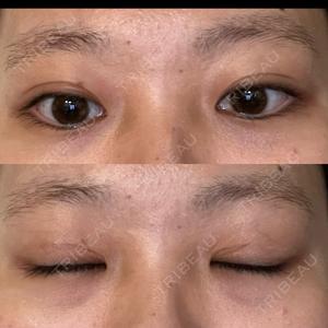 藤・ナチュレ美容クリニック 藤・ナチュレ美容クリニック 恵比寿院口コミ