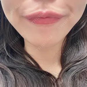 TCB東京中央美容外科 TCB東京中央美容外科 新宿東口院口コミ