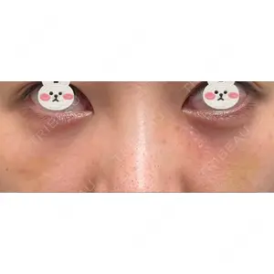 APOLLO BEAUTY CLINIC口コミ