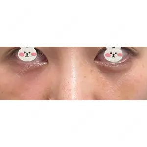 APOLLO BEAUTY CLINIC口コミ