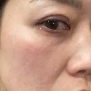 TCB東京中央美容外科 TCB東京中央美容外科 心斎橋院口コミ