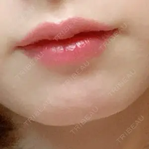 東京シンデレラ美容外科 東京シンデレラ美容外科 池袋院口コミ