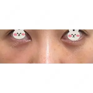 APOLLO BEAUTY CLINIC口コミ