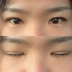 アリエル美容クリニック アリエル美容クリニック 郡山院口コミ