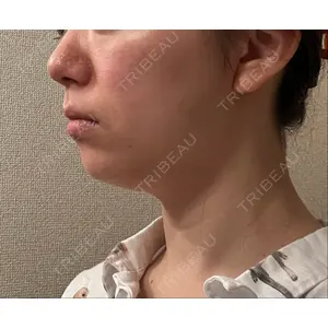 ルネッサンス美容外科医院 ルネッサンス美容外科医院 青山本院口コミ