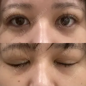 アリエル美容クリニック アリエル美容クリニック 郡山院口コミ