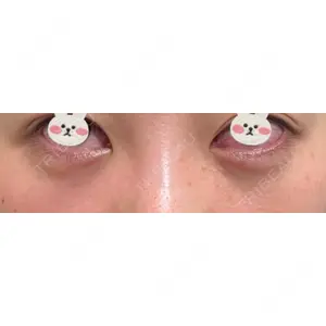 APOLLO BEAUTY CLINIC口コミ